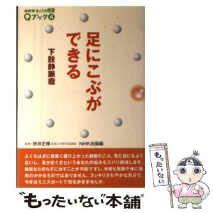 【中古】 足にこぶができる 下肢静脈瘤 / NHK出版 / NHK出版 [単行本]【メール便送料無料】【あす楽対応】