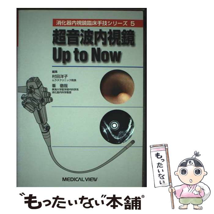 【中古】 超音波内視鏡up　to　now / 村田 洋子, 峯 徹哉 / メジカルビュー社 [単行本]【メール便送料無料】【最短翌日配達対応】