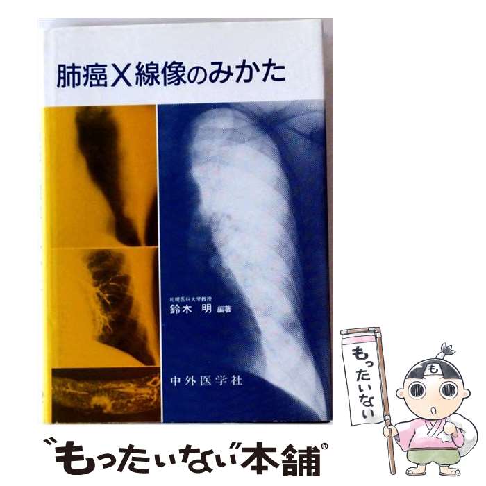 【中古】 肺癌X線像のみかた / 前札幌医科大学教授鈴木 明 / 中外医学社 [単行本]【メール便送料無料】【最短翌日配達対応】