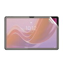 エムディーエス Lenovo Tab M11対応 液晶保護フィルム マット(MDS-UGFLLTM11) 取り寄せ商品