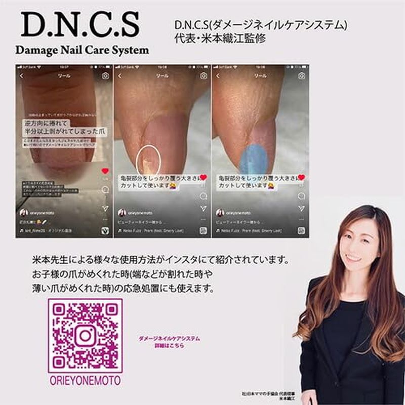 �ӥ塼�ƥ����ͥ��顼 ���᡼���ͥ��륱��������(DNCS-1)