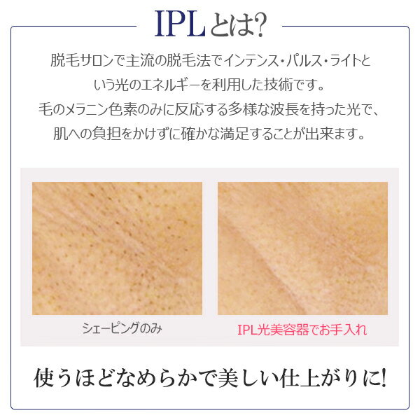 【ポイント15倍】【再入荷】【1年保証】COSBEAUTY IPL光美容器 Perfect Smooth コスビューティー パーフェクトスムース メーカー直送 デリケートゾーン 顔 ヒゲ VIO プレゼント ギフト【送料無料】【あす楽】【beautyd20】