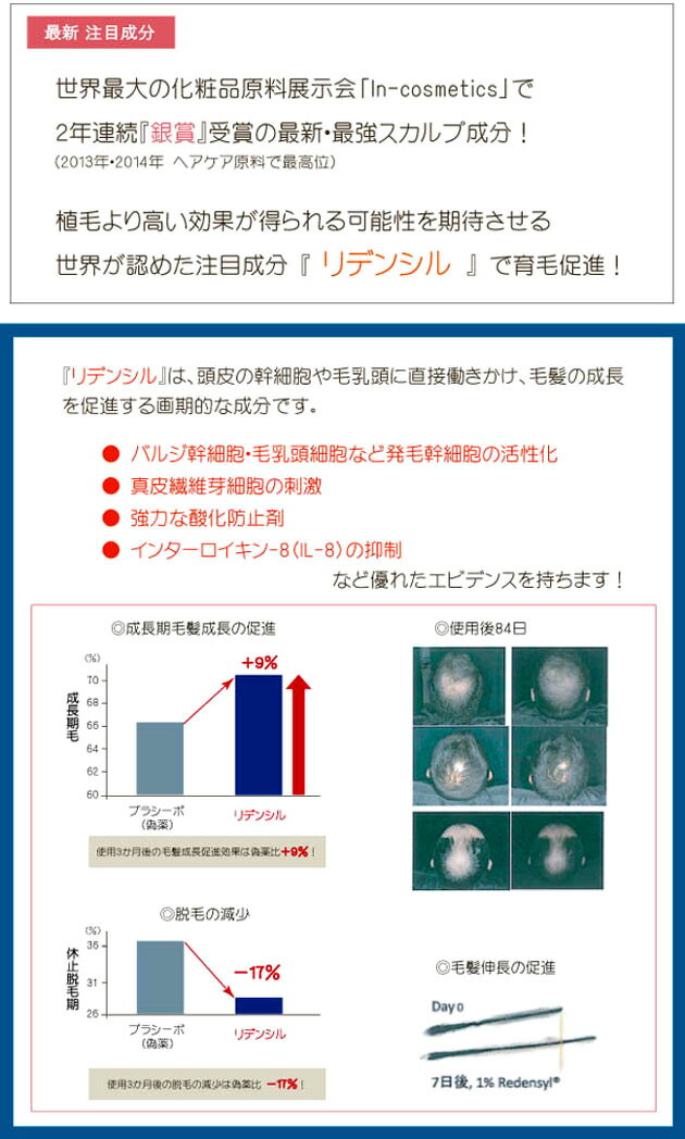 【送料無料】Avidence（アビデンス）スカルプ リキッド 50ml×5本セット：★今最強の育毛成分リデンシル＋キャピキシル配合！サロン専売 業務用育毛剤抜け毛・薄毛対策に！フケ・頭皮のかゆみ・白髪対策に！本格育毛サロン業務用スカルプエッセンス