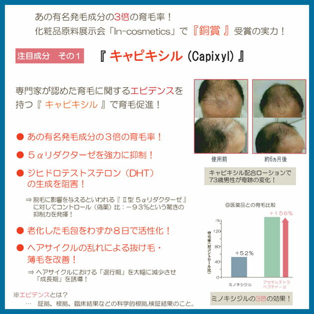 CroixスカルプエッセンスEXプラス 120ml×5本：2年連続「銀賞」受賞の注目育毛成分 リデンシル＋あの発毛成分の3倍の実力 キャピキシル配合！ EGF FGF IGF 配合！抜け毛対策 抜け毛防止 薄毛対策 育毛サロン専売品育毛剤