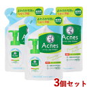 3Zbg ANlX(Acnes) pӂӂȖA ߂p 140ml \[^(MENTHOLATUM) [g(ROHTO)yz