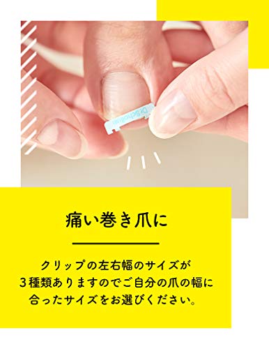 【一般医療機器】巻き爪 矯正ドクターショール 巻き爪クリップ S 1個