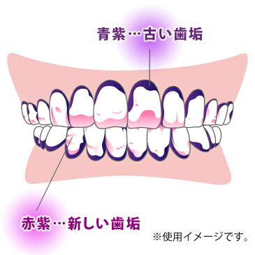 Ci ダブルプラークチェッカー (歯垢染色液) 1本(50ml) グレープフレーバー【MB】