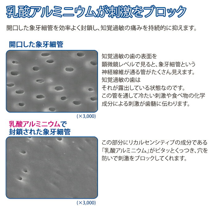 【メール便選択で送料無料】リカル歯磨き剤センシティブオレンジミント1本(70g)(知覚過敏用歯磨き粉)※従来品の在庫がなくなり次第、リニューアル品(フッ素1450ppm)でのお届けとなる場合がございます。(メール便5点まで)