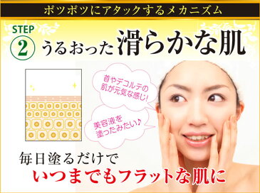 プッチフラットクリーム 医薬部外品★気になるぽつぽつ対策にハトムギエキス&ビフィズス菌配合♪