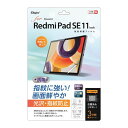 Digio2 Redmi Pad SE 11インチ用 液晶保護フィルム 光沢・指紋防止 TBF-XIT02FLS【日時指定不可】(2)