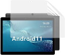 ALLDOCUBE iPlay20S 10.1 フィルム ブルーライトカット 反射低減 抗菌 アンチグレア 指紋防止 気泡防止 液晶 保護フィルム 画面保護シー...
