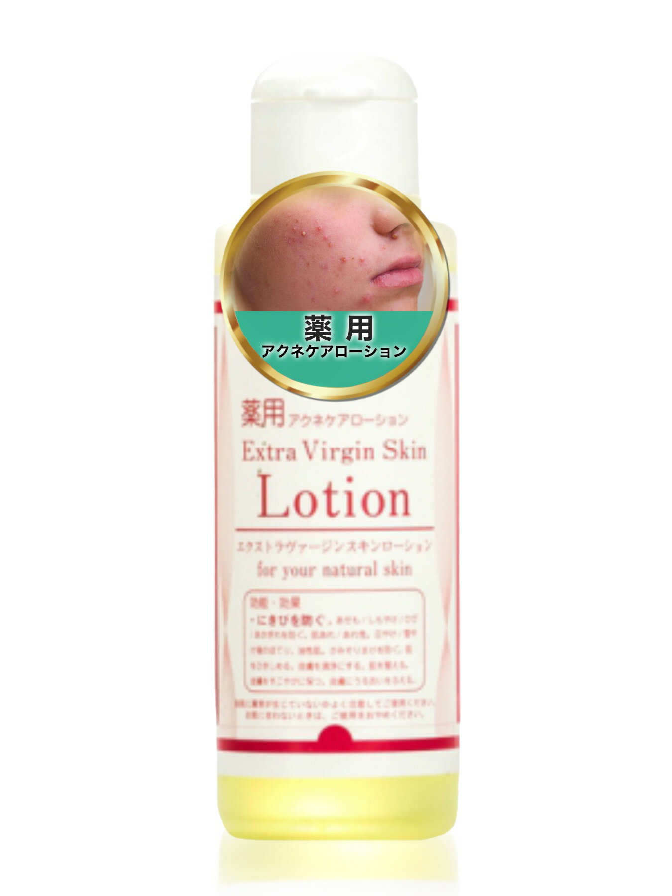 Rakuten - 薬用 アクネケアローション エクストラヴァージンスキンローション ニキビ にきび スキンケア 医薬部外品 肌荒れ 100ml