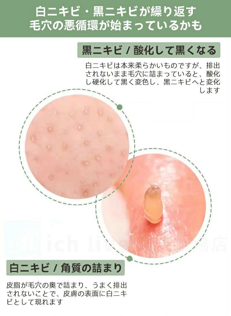 どんすずの角栓取り 角栓 角栓クレンジング 黒ずみ 毛穴すっきり 汚れ ポアクリーンピーラー 押し出す クリーナー 頬の毛穴 ケア｜アングル3