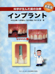 科学が生んだ歯の治療インプラント 中村公雄/著 小野善弘/著 松井徳雄/著 佐々木猛/著