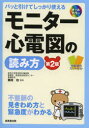 モニター心電図の読み方　パッと引けてしっかり使える　不整脈の見きわめ方と緊急度がわかる　剱持功/監修