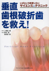 垂直歯根破折歯を救え! いざという時使いたいサイエンス＆テクニック 二階堂徹/監修 菅谷勉/執筆 海老原新/執筆