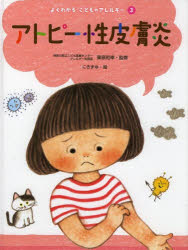 よくわかるこどものアレルギー 3 アトピー性皮膚炎 栗原和幸/監修