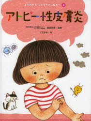 よくわかるこどものアレルギー 3 アトピー性皮膚炎 栗原和幸/監修