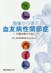 画像から学ぶ血友病性関節症 早期治療のために 血友病性関節症Study Group/編集
