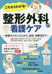 これならわかる!整形外科の看護ケア　疾患のメカニズムから、症状、治療法まで　松本守雄/総監修　瀬戸美奈子/監修