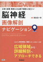 脳神経画像解剖ナビゲーション 正常・変異・異常との比較で読影に役立つ! 岡本浩一郎/編著