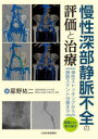 慢性深部静脈不全の評価と治療 弾性ストッキングから静脈ステント治療まで 星野祐二/著
