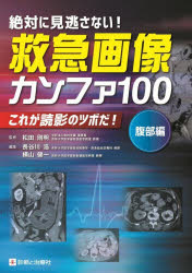 絶対に見逃さない!救急画像カンファ100　これが読影のツボだ!　腹部編　松田剛明/監修　長谷川浩/編集　横山健一/編集