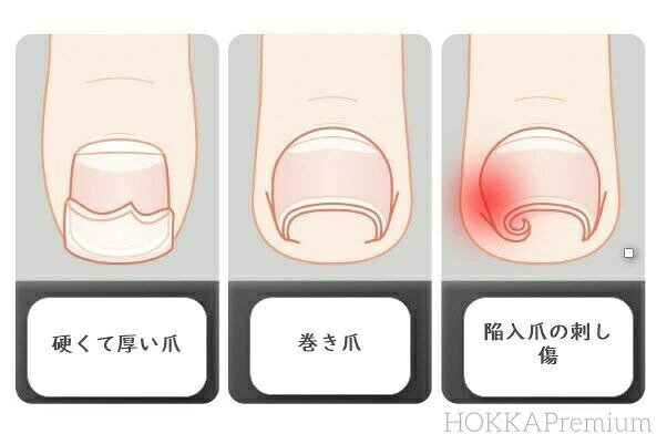 DOUX & FLEURETTEのネイルケアツールセット 高性能爪切りセット｜男女兼用・収納ケース付き 12点／1 点｜巻き爪・厚爪対応｜アングル2