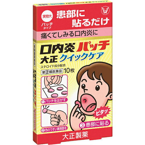 ■口内炎パッチ大正クイックケア 10枚【大正製薬】 ◆口内炎パッチ大正クイックケアは“貼る”口内炎治療薬です。口腔内ですぐれた付着力をもち，患部を刺激からしっかりカバーし，また，成分が持続的に作用します。 ◆「口内炎(アフタ性)」とは・・・ 　 頬の内側や舌，唇の裏側などに，周りが赤っぽく，中央部が浅くくぼんだ白っぽい円形の痛みを伴う浅い小さな潰瘍(直径10mm未満)が1〜数個できた炎症の総称です。 　 原因は明確ではありませんが，ストレス，疲労，あるいは栄養摂取の偏りが関与すると言われています。 内容量 10枚 効能・効果 口内炎(アフタ性) 使用上の注意 ●してはいけないこと (守らないと現在の症状が悪化したり，副作用が起こりやすくなります) 次の人は使用しないでください 　（1）感染性の口内炎が疑われる人。(医師，歯科医師，薬剤師又は登録販売者に相談してください) 　　・ガーゼなどで擦ると容易に剥がすことのできる白斑が口腔内全体に広がっている人。(力ンジダ感染症が疑われます) 　　・患部に黄色い膿がある人。(細菌感染症が疑われます) 　　・口腔内に米粒大〜小豆大の小水疱が多発している人，口腔粘膜以外の口唇、皮膚にも水疱，発疹がある人。(ウイルス感染症が疑われます) 　　・発熱，食欲不振，全身倦怠感，リンパ節の腫脹などの全身症状がみられる人。(ウイルス感染症が疑われます) 　（2）口腔内に感染を伴っている人。(ステロイド剤の使用により感染症が悪化したとの報告があることから，歯槽膿漏，歯肉炎等の口腔内感染がある部位には使用しないでください) 　（3）5日間使用しても症状の改善がみられない人。 　（4）1〜2日間使用して症状の悪化がみられる人。 ●相談すること 1．次の人は使用前に医師，歯科医師，薬剤師又は登録販売者に相談してください 　（1）医師又は歯科医師の治療を受けている人。 　（2）薬などによりアレルギー症状を起こしたことがある人。 　（3）妊婦又は妊娠していると思われる人。 　（4）授乳中の人。 　（5）患部が広範囲(患部を本剤でおおいきれない)にある人。 　（6）高齢者。 2．使用後，次の症状があらわれた場合は副作用の可能性があるので，直ちに使用を中止し，この説明書を持って医師，歯科医師，薬剤師又は登録販売音に相談してください 　　　　[関係部位：症状] 　　　　口腔内：白斑(力ンジタ感染症が疑われる)，患部に黄色い膿がある(細菌感染症が疑われる)　　 　　上記の症状のほか，アレルギー症状(気管支喘息発作，浮腫等)があらわれた揚合 3．本剤使用後，次の症状があらわれた場合には，感染症による口内炎や他疾患による口内炎が疑われるので，医師，歯糾医師，薬剤師又は登録販売者に相談してください 　　　発熱，食欲不振，全身倦怠感，リンパ節の腫脹，水疱(口腔内以外)，発疹・発赤，かゆみ，口腔内の患部が本剤でおおいきれないくらい広範囲に広がる，目の痛み，かすみ目，外陰部潰瘍 成分・分量 1枚(1パッチ)中 トリアムシノロンアセトニド・・・0.025mg 添加物として、ポリアクリル酸，ク工ン酸トリエチル，ヒプロメロース，エチルセルロース，ヒマシ油，酸化チタン，赤色102号を含有する。 用法・用量 1患部に1回1枚を1日1〜2回，患部粘膜に付着させて用いてください 5才未満は使用しないこと ＜用法関連注意＞ （1）定められた用法・用量を厳守してください。 （2）本剤は溶けません。時間が経つと自然にはがれます。(無理にはがさないでください) （3）本剤はロ腔内粘膜貼付剤ですので，内服しないでください。 （4）痛みが治まったら使用を終了してください。(使用中のものをはがしとる必要はありません) （5）5才未満の乳幼児には使用させないでください。 （6）5才以上の小児に使用させる場合には，保護者の指導監督のもとに使用させてください。 （7）小児への使用においては，貼付後，指ではがしとるおそれがありますので注意してください。 （8）もし誤って飲み込んでしまった場合，新しい薬を患部に貼りなおしてください。万が一，症状が変わるなど，不安に思うことがありましたら医師，歯科医師，薬剤師又は登録販売者に相談してください。 （9）使用方法をまちがえると付着しないことがあるので，使用方法をよく読んで正しく使用してください。 （10）本剤を患部粘膜に付着させた後，舌などで強くさわると，はがれることがあるので注意してください。 （11）はがれたものは飲みこまずに捨ててください。 保管及び取扱い上の注意 （1）直射日光の当たらない湿気の少ない涼しい所に保管してください。 （2）小児の手のとどかない所に保管してください。 （3）他の容器に入れかえないでください。(誤用の原因になったり品質が変わることがあります) （4）品質保持のため，開封後の未使用分はもとの袋に入れ，開封口をきちんと折り曲げて保管してください。 （5）使用期限の過ぎた製品は使用しないでください。なお，使用期限内であっても，開封後はなるべく早く使用してください。 使用期限 使用期限まで180日以上あるものをお送りします。 製造販売元 ＜販売元＞ 大正製薬株式会社 東京都豊島区高田3丁目24番1号 【お客様119番室】 電話：03-3985-1800 受付時間：8：30〜21：00（土，日，祝日を除く） ＜製造販売元＞ 帝國製薬株式会社 香川県東かがわ市三本松567 広告文責 多賀城ファーマシー株式会社 薬剤師：根本一郎 TEL：022-362-1675 原産国 日本 リスク区分 第(2)類医薬品 ※パッケージデザイン・内容量等は予告なく変更されることがあります。 ■この商品は医薬品です。用法・用量を守り、正しくご使用下さい。 医薬品販売に関する記載事項（必須記載事項）はこちら