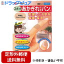 【本日楽天ポイント5倍相当】【定形外郵便で送料無料】ニチバンあかぎれ保護バン スポット用 30枚 【ドラッグピュア楽天市場店】【TK140】