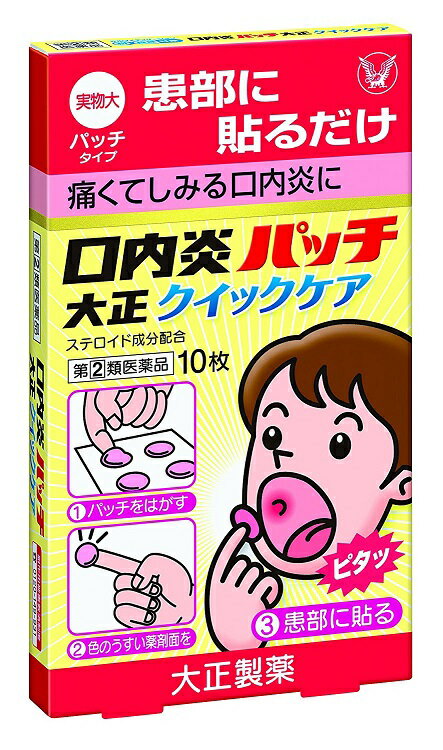 商品説明 「口内炎パッチ 大正クイックケア 10枚」は、『貼る』口内炎治療薬です。口腔内ですぐれた付着力をもち、患部を刺激からしっかりカバーし、また、成分が持続的に作用します。医薬品。 使用上の注意 ●してはいけないこと (守らないと現在の症状が悪化したり、副作用が起こりやすくなります) 次の人は使用しないでください (1)感染性の口内炎が疑われる人。(医師、歯科医師、薬剤師又は登録販売者に相談してください) ・ガーゼなどで擦ると容易に剥がすことのできる白斑が口腔内全体に広がっている人。(力ンジダ感染症が疑われます) ・患部に黄色い膿がある人。(細菌感染症が疑われます) ・口腔内に米粒大-小豆大の小水疱が多発している人、口腔粘膜以外の口唇、皮膚にも水疱、発疹がある人。(ウイルス感染症が疑われます) ・発熱、食欲不振、全身倦怠感、リンパ節の腫脹などの全身症状がみられる人。(ウイルス感染症が疑われます) (2)口腔内に感染を伴っている人。(ステロイド剤の使用により感染症が悪化したとの報告があることから、歯槽膿漏、歯肉炎等の口腔内感染がある部位には使用しないでください) (3)5日間使用しても症状の改善がみられない人。 (4)1-2日間使用して症状の悪化がみられる人。 ●相談すること 1.次の人は使用前に医師、歯科医師、薬剤師又は登録販売者に相談してください (1)医師又は歯科医師の治療を受けている人。 (2)薬などによりアレルギー症状を起こしたことがある人。 (3)妊婦又は妊娠していると思われる人。 (4)授乳中の人。 (5)患部が広範囲(患部を本剤でおおいきれない)にある人。 (6)高齢者。 2.使用後、次の症状があらわれた場合は副作用の可能性があるので、直ちに使用を中止し、この説明書を持って医師、歯科医師、薬剤師又は登録販売音に相談してください 関係部位 症状 口腔内 白斑(カンジダ感染症が疑われる)、患部に黄色い膿がある(細菌感染症が疑われる) 上記の症状のほか、アレルギー症状(気管支喘息発作、浮腫等)があらわれた場合 3.本剤使用後、次の症状があらわれた場合には、感染症による口内炎や他疾患による口内炎が疑われるので、医師、歯科医師、薬剤師又は登録販売者に相談してください 発熱、食欲不振、全身倦怠感、リンパ節の腫脹、水疱(口腔内以外)、発疹・発赤、かゆみ、口腔内の患部が本剤でおおいきれないくらい広範囲に広がる、目の痛み、かすみ目、外陰部潰瘍 効能・効果 口内炎(アフタ性) 『口内炎(アフタ性)』とは：頬の内側や舌、唇の裏側などに、周りが赤っぽく、中央部が浅くくぼんだ白っぽい円形の痛みを伴う浅い小さな潰瘍(直径10mm未満)が1-数個できた炎症の総称です。原因は明確ではありませんが、ストレス、疲労、あるいは栄養摂取の偏りが関与すると言われています。 用法・用量 年齢 使用方法 成人(15才以上) 1患部に1回1枚を1日1-2回、患部粘膜に付着させて用いてください 小児(5才以上) 5才未満 使用しないこと 【注意】 (1)定められた用法・用量を厳守してください。 (2)本剤は溶けません。時間が経つと自然にはがれます。(無理にはがさないでください) (3)本剤はロ腔内粘膜貼付剤ですので、内服しないでください。 (4)痛みが治まったら使用を終了してください。(使用中のものをはがしとる必要はありません) (5)5才未満の乳幼児には使用させないでください。 (6)5才以上の小児に使用させる場合には、保護者の指導監督のもとに使用させてください。 (7)小児への使用においては、貼付後、指ではがしとるおそれがありますので注意してください。 (8)もし誤って飲み込んでしまった場合、新しい薬を患部に貼りなおしてください。万が一、症状が変わるなど、不安に思うことがありましたら医師、歯科医師、薬剤師又は登録販売者に相談してください。 (9)使用方法をまちがえると付着しないことがあるので、使用方法をよく読んで正しく使用してください。 (10)本剤を患部粘膜に付着させた後、舌などで強くさわると、はがれることがあるので注意してください。 (11)はがれたものは飲みこまずに捨ててください。 【パッチの貼り方】 ●パッチの表裏に注意してください。 (1)うがいなどで患部を清潔にした後、患部の水分・唾液などを軽くふき取ってください。 (2)シートからパッチをはがします。シートを少し曲げながらはがすと簡単にはがれます。 (3)表側の台紙に付着していないうすい色の面が患部につける薬剤面です。(パッチの表裏に注意してください) (4)パッチの裏側の色の濃い面を指先にとります。(この際、指先を少し湿らせておくと、扱いやすくなります) (5)うすい色の薬剤面を患部に軽く押しあて、接するように貼ってください。 (6)指で数秒間おさえた後、そっと指を離してください。 ●患部が唾液などでぬれていると、つきにくいことがあります。 成分・分量 1枚(1パッチ)中 成分 分量 働き トリアムシノロンアセトニド 0.025mg 患部の炎症を鎮め、口内炎を改善します。 添加物：ポリアクリル酸、クエン酸トリエチル、ヒプロメロース、エチルセルロース、ヒマシ油、酸化チタン、赤色102号 ※本剤の主な素材はセルロース類(繊維成分)なので、万一誤って本剤を飲み込んでしまっても消化されず体外に排出されます。 保管および取扱い上の注意 (1)直射日光の当たらない湿気の少ない涼しい所に保管してください。 (2)小児の手のとどかない所に保管してください。 (3)他の容器に入れかえないでください。(誤用の原因になったり品質が変わることがあります) (4)品質保持のため、開封後の未使用分はもとの袋に入れ、開封口をきちんと折り曲げて保管してください。 (5)使用期限の過ぎた製品は使用しないでください。なお、使用期限内であっても、開封後はなるべく早く使用してください。 お問い合わせ先 この製品についてのお問い合わせは、お買い求めのお店又は下記にお願い申し上げます。 連絡先：大正製薬株式会社 お客様119番室 電話：03-3985-1800 受付時間：8：30-21：00(土、日、祝日を除く) 発売元 大正製薬株式会社 東京都豊島区高田3丁目24番1号 製造販売元 帝國製薬株式会社 香川県東かがわ市三本松567番地 副作用被害救済制度のお問い合わせ先 (独)医薬品医療機器総合機構 電話：0120-149-931(フリーダイヤル) 製品名 口内炎パッチ大正クイックケア 一般用医薬品の使用期限 使用期限まで100日以上ある医薬品をお届けします。 商品区分：【第(2)類医薬品】 医薬品販売に関する記載事項 文責：株式会社ドラッグWAKUWAKU　登録販売者　桑原　芳浩 広告文責：株式会社ドラッグWAKUWAKU TEL：0439-50-3389
