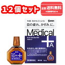 【第2類医薬品】■使用期限2026年12月【送料無料】サンテメディカルプラス アクティブ 12ml×12個セット【参天製薬】
