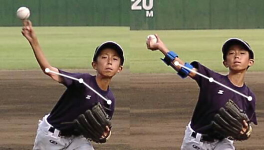 アメリカで爆発的なヒット スローマックススポーツ アウトドア Mft 野球 エムエフティー 野球 スローイング矯正用品 スローイング矯正用品 スローマックス スポーツダグアウト アメリカで爆発的なヒット スローマックススポーツ アウトドア Mft 野球 エムエフティー 野球 スローイング矯正用品 スローイング矯正用品 スローマックス スポーツダグアウト