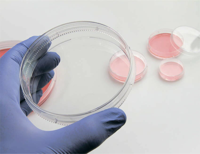 【画像はイメージです】【納期について】発送日が配送予定を超える場合は、別途メールや問合せフォームにてご相談いたします。★数量・大口割引も受付中！お問い合わせください。 ■ イージーディッシュ 35mm の特長 Nunclon? Delta処理により細胞付着性・増殖性を促進。 エアーベント付ディッシュはフタ内側に通気性を維持するためのベントが付いています。 イージーディッシュは操作性、通気性が向上した新デザインです。 無毒性・パイロジェンフリー。γ線滅菌済。 材質：PS 外寸法（mm） 40×13 容量（ml） 3 入数 500【画像はイメージです】【納期について】発送日が配送予定を超える場合は、別途メールや問合せフォームにてご相談いたします。★数量・大口割引も受付中！お問い合わせください。 ■ イージーディッシュ 35mm の特長 Nunclon? Delta処理により細胞付着性・増殖性を促進。 エアーベント付ディッシュはフタ内側に通気性を維持するためのベントが付いています。 イージーディッシュは操作性、通気性が向上した新デザインです。 無毒性・パイロジェンフリー。γ線滅菌済。 材質：PS 外寸法（mm） 40×13 容量（ml） 3 入数 500