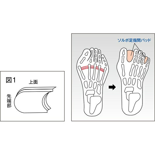 イースクエアのソルボ足指間パッド｜アングル2
