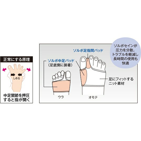 イースクエアのソルボ外反母趾サポーター スーパーメッシュ薄型 ベージュ 2L右｜アングル3
