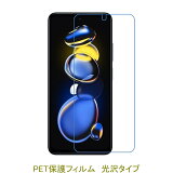 2 Xiaomi Redmi Note 11 Pro 5G 6.67 2022ǯ5 վݸե  ꥢ