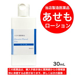 あせも ローション 【薬局製造販売医薬品】 えびす調剤薬局 GLPZ液 30mL あせも 市販 市販薬 薬 子供 子ども 幼児 赤ちゃん 汗疹 汗 ローション アセモトール えびす薬局 エビス 調剤 紅色汗疹 水晶様汗疹 女児 男児 キッズ おすすめ 予防 おしり 首 対策 かゆみ 虫刺され