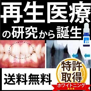 口コミから大ヒット♪【送料無料】ポリリンホワイト EX 医薬部外品 薬用歯磨き 内容量19mL 1本_※約1ヶ月分 歯磨きポリリン酸配合 口臭対策 ホワイトニング WHITENING トゥース リジェンティス