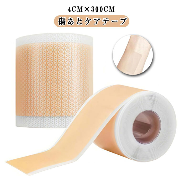 4cm×300cm 傷あとケアテープ【手術後の傷あとをしっかりきれいに保護】肌にやさしいシリコンテープを採用し、術後のデリケートな傷あとを丁寧に守ります。【伸展刺激を抑える】高い伸縮性をもつシリコンテープが、傷あとが伸びて広がるのを防ぎます。【摩擦刺激を軽減】衣類や下着がこすれることで起こる刺激から傷あとを守り、負担を減らします。【紫外線対策】敏感な傷あとを紫外線からしっかり保護します。【水分からガード】水分の侵入を防ぎ、傷あとを清潔に保ちながらきれいな仕上がりへ導きます。 サイズ 4cm×300cm サイズについての説明 4cm×300cm 素材 シリコン 色 肌色 備考 ●サイズ詳細等の測り方はスタッフ間で統一、徹底はしておりますが、実寸は商品によって若干の誤差(1cm～3cm )がある場合がございますので、予めご了承ください。 ●製造ロットにより、細部形状の違いや、同色でも色味に多少の誤差が生じます。 ●パッケージは改良のため予告なく仕様を変更する場合があります。 ▼商品の色は、撮影時の光や、お客様のモニターの色具合などにより、実際の商品と異なる場合がございます。あらかじめ、ご了承ください。 ▼生地の特性上、やや匂いが強く感じられるものもございます。数日のご使用や陰干しなどで気になる匂いはほとんど感じられなくなります。 ▼同じ商品でも生産時期により形やサイズ、カラーに多少の誤差が生じる場合もございます。 ▼他店舗でも在庫を共有して販売をしている為、受注後欠品となる場合もございます。予め、ご了承お願い申し上げます。 ▼出荷前に全て検品を行っておりますが、万が一商品に不具合があった場合は、お問い合わせフォームまたはメールよりご連絡頂けます様お願い申し上げます。速やかに対応致しますのでご安心ください。