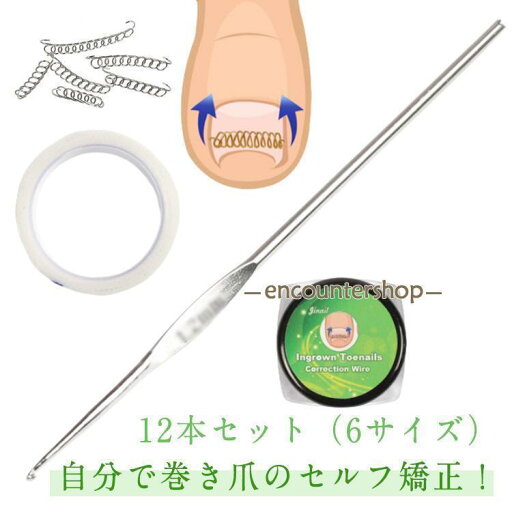 巻爪 テープ付き 巻き爪 矯正 爪ワイヤー 巻き爪 巻き爪矯正グッズ 巻き爪チェーン 矯正テープ ワイヤー ガード テープ 巻きづめ 靴 足の巻き爪 巻爪 テープ付き 巻き爪 矯正 爪ワイヤー 巻き爪 巻き爪矯正グッズ 巻き爪チェーン 矯正テープ ワイヤー ガード テープ 巻きづめ 靴 足の巻き爪