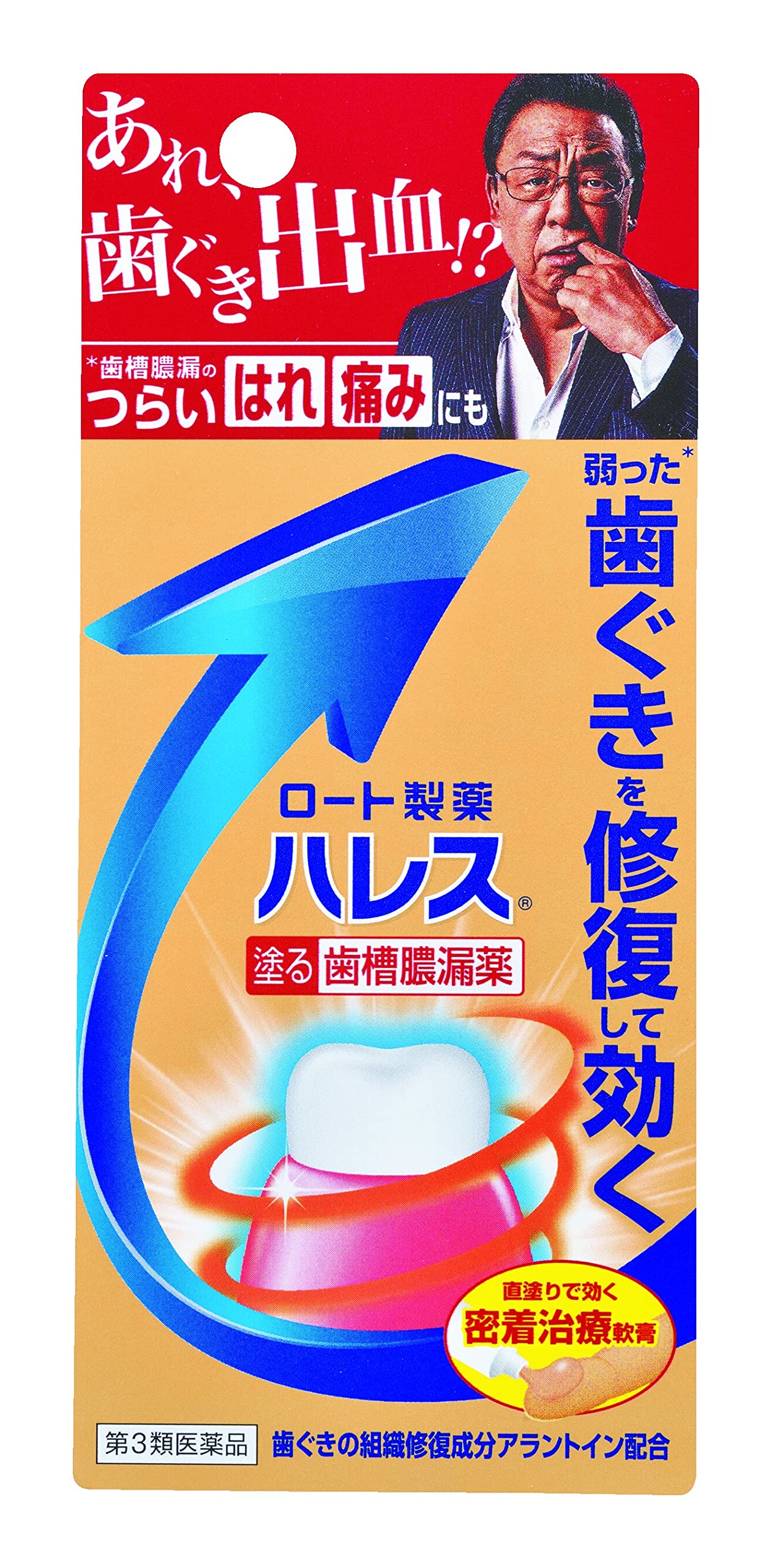 第3類医薬品ハレス口内薬 15g