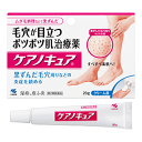 【第2類医薬品】【小林製薬】ケアノキュア20g※セルフメディケーション税制対象医薬品