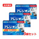 【第2類医薬品】【メール便対応・送料無料!3個セット】アレジオン20【24錠】×3セット【エスエス製薬】※セルフメディケーション税制対象商品