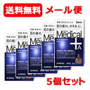 【第2類医薬品】【参天製薬】メール便 送料無料 5個セットサンテメディカルプラスアクティブ (青)12ml ×5※セルフメディケーション税制対象商品