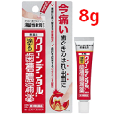 【第3類医薬品】【第一三共】 クリーンデンタルN 8g塗る歯槽膿漏薬 【赤箱】