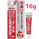 【第3類医薬品】【第一三共】 クリーンデンタルN 16g塗る歯槽膿漏薬 【赤箱】