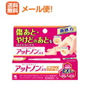 【第2類医薬品】【メール便送料無料!】【小林製薬】アットノン EX クリーム 15g
