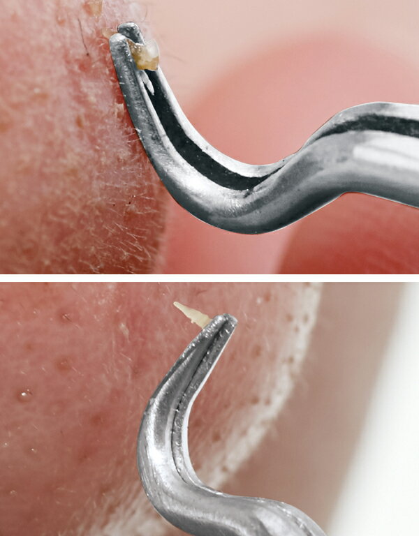 �ץ륪���ץ�ԥ󥻥åȡ�90486