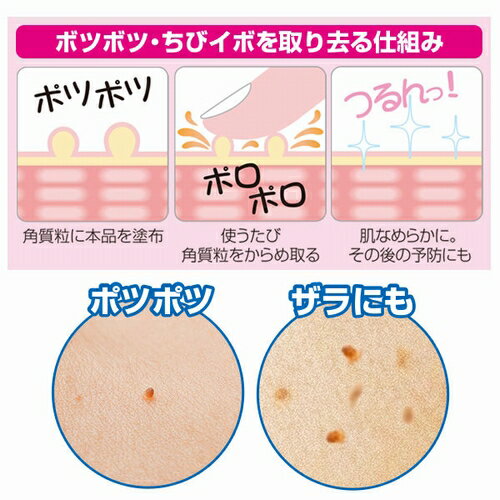 【ネコポス/ポスト投函】首 イボ ポロポロ いぼ イボ取り 除去 クリーム 角質粒 医薬部外品 薬用ピーリングスムーサーEX 25g 送料無料 正規品